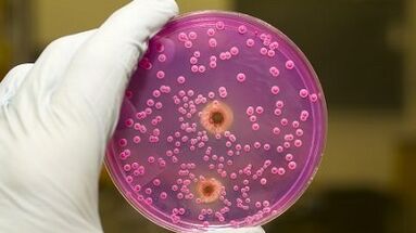 Pathological discharge in men when they are excited