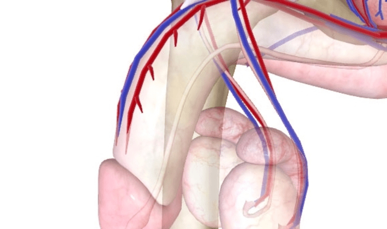 Bad blood supply in penis